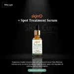 skinO Acne + Spot Treatment Serum-30ml